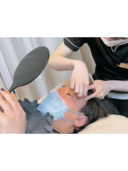 顔脱毛がしたい