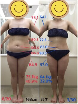 エスティフル 狭山店(ESTIFUL)/[痩身エステ]Before/After