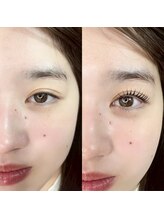 エイル ビューティ スタジオ(EIL beauty studio)/