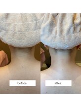 ミーティスジータ(mitis Gita)/うなじ脱毛