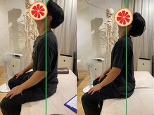 グレフル鍼灸接骨院 整体院 心斎橋/整体/肩こり/マッサージ/腰痛