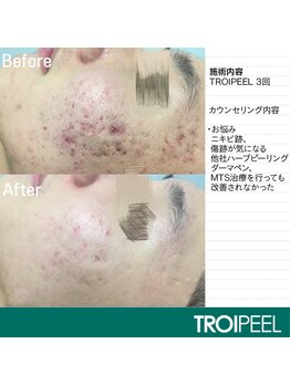 オン(on.)/《お客様症例》施術3回