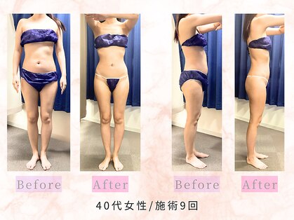 パラディ(PARADIS)の写真