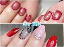 ララン(Laran)/