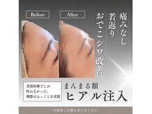 レア(Rea)の雰囲気(高濃度美容成分が肌深部に浸透☆高浸透リジェセルも導入♪)