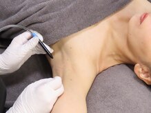 ノルテ(NOLTE)の雰囲気（気になる数本の残った毛も仕上げられます）