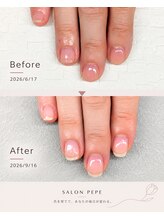 サロンペペ(salon pepe)/３カ月で小さな爪を育てる