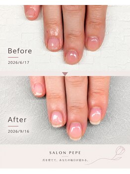 サロンペペ(salon pepe)/3カ月で小さな爪を育てる