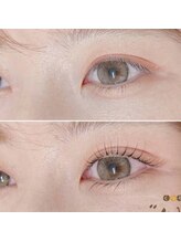 フー(woo)/ラッシュリフト