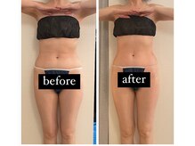 ジーニー(Genie)/痩せたい！痩せれます！