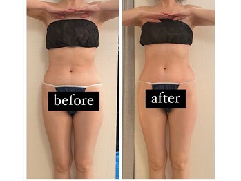 ジーニー(Genie)/痩せたい！痩せれます！