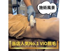 30,40代からの支持率上昇中！《顔・VIO・全身脱毛》#全身脱毛