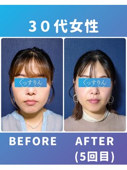 ぐっすりん/複数回継続のお客様の変化(1)