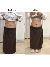 ジョワイユ(Joyeux)/腸の位置でお腹は変わる