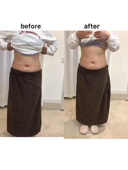 ジョワイユ(Joyeux)/腸の位置でお腹は変わる