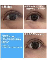 エンフィール(&.Feel)/目元クマ改善