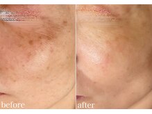 オリエンタルビューティー(ORIENTAL BEAUTY)