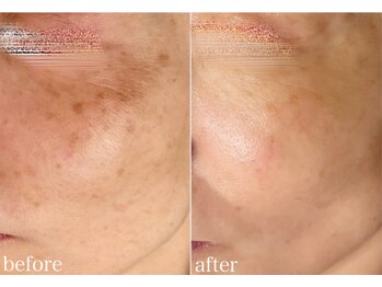 オリエンタルビューティー(ORIENTAL BEAUTY)