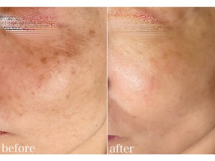 オリエンタルビューティー(ORIENTAL BEAUTY)の写真