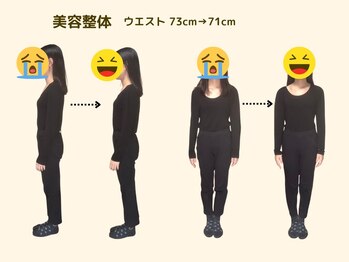 アロゼ/美容整体