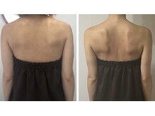 SALON　F【クリスティーナ/リンパ/小顔/痩身】【3月中旬OPEN（予定）】