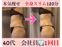 マール(Mar)/1回の結果出し！痩身/全身スリム