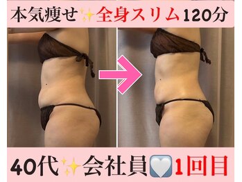 マール(Mar)/1回の結果出し!痩身/全身スリム