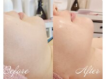 ルポ 鶴見(Repos)/シュっとした輪郭に★小顔ケア