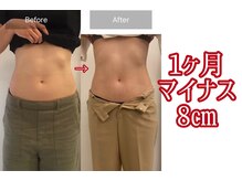 キレピア 新市街店(kirepia)/痩せるだけじゃない♪