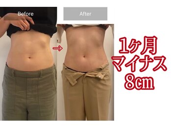 キレピア 新市街店(kirepia)/痩せるだけじゃない♪