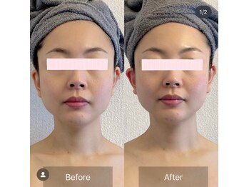 サロン ド カシェット 銀座/お客様のビフォーアフター例