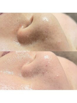 サロンドリー(salon de Re)/超音波エクストラクション