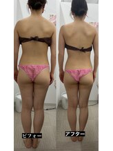 メリアミーゴ(Meli amigo)/下半身改善