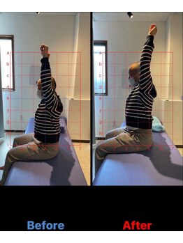 松戸駅前鍼灸院 整骨院/歪み/骨格矯正/猫背/姿勢改善