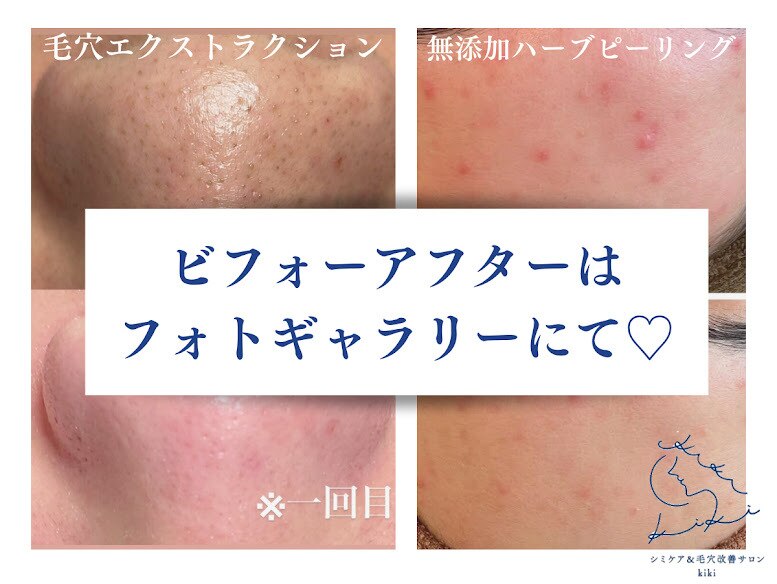 キキ(kiki)｜ホットペッパービューティー