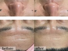 エステサロン ジョアアンジェ(joie ange)/シルク 1回