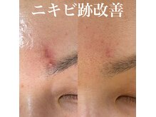 レイアップ(Leiup)の雰囲気（【プロセルセラピーズ】頭皮／フェイシャルのお悩みに最速ケア）