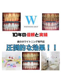 ホワイトニング ショップ 金沢店/食事制限なし美白ホワイトニング