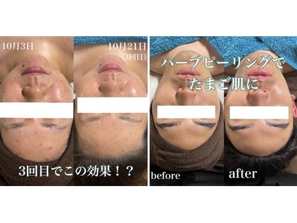 サロン リティナ(Salon Ritina)の写真