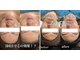 サロン リティナ(Salon Ritina)の写真