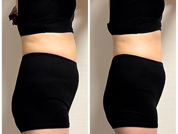 リンド(Lindo)/ぽっこりお腹スッキリ!