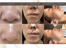 リエイト(Re:eight)