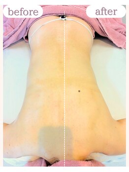 ワム(Wom)/肋骨締めでウエストにくびれが♪