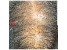 ニューユー(NewYou)の雰囲気（ホームケアなし！ノアグロウスカルプのみ♪）