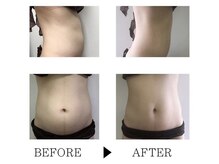 ソルニスクア(Solnis.qua)/