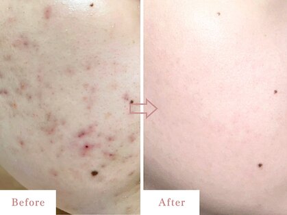 ベル 戸塚(Belle)の写真