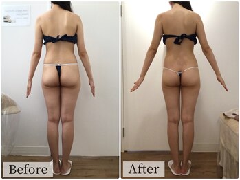 ボーレーヴ(beau reve)/ブライダル/インディバ/痩身