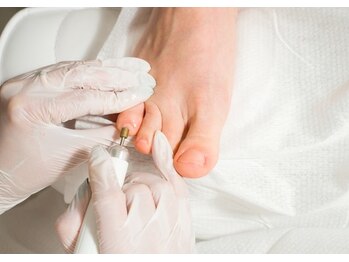 手に負えない爪に、フスフレーゲ