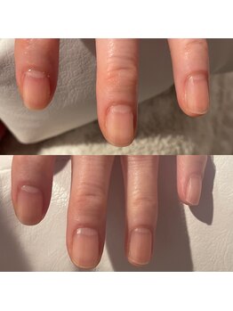 サロンドエー 帝塚山(Salon de A)/ジェル出来ない方の爪事情!