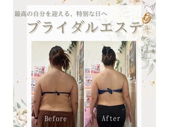 ラフィール/ブライダルエステ
